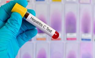 سازمان جهانی بهداشت نخستین آزمایش خانگی ویروس هپاتیت سی را تائید کرد