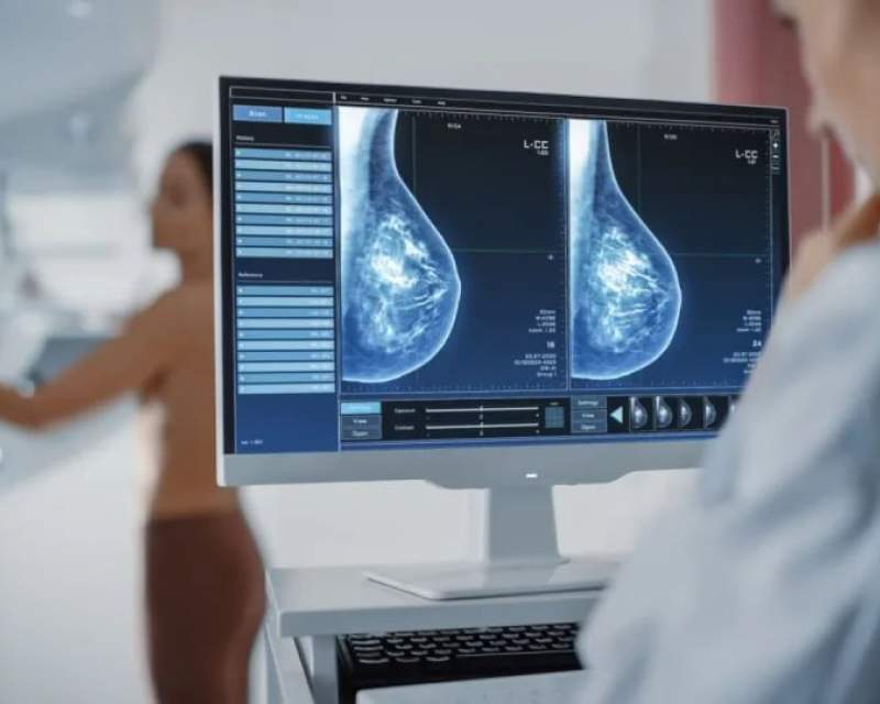 قطر استفاده از هوش مصنوعی را در غربالگری سرطان پستان آغاز کرد