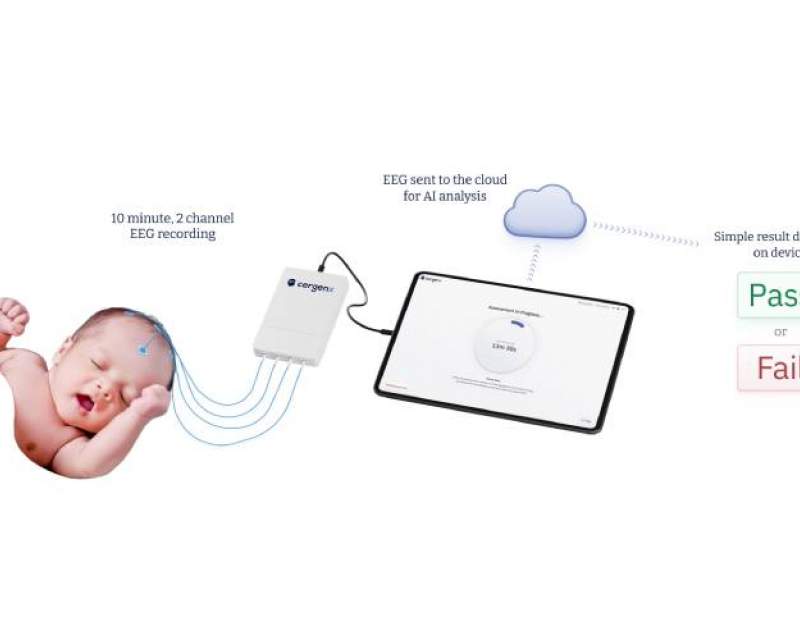 دستگاه پایش مغز نوزادان سرجن ایکس موقعیت یک دستگاه پیشرو را از FDA گرفت